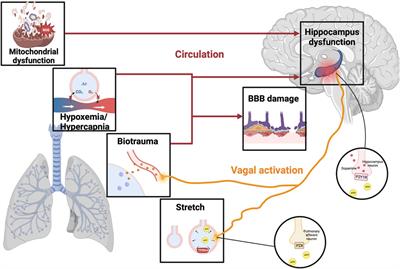 Future directions in ventilator-induced lung injury associated cognitive impairment: a new sight